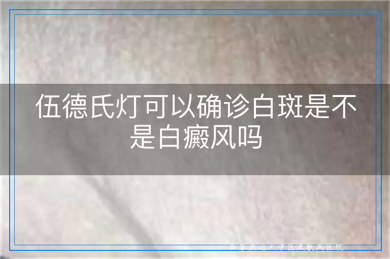 伍德氏灯可以确诊白斑是不是白癜风吗