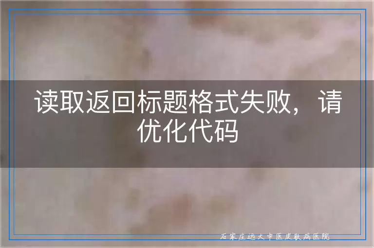 读取返回标题格式失败,请优化代码