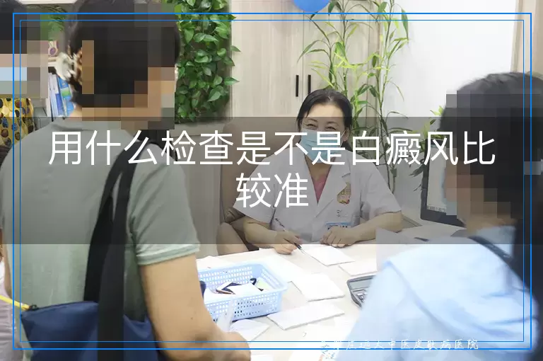 用什么检查是不是白癜风比较准