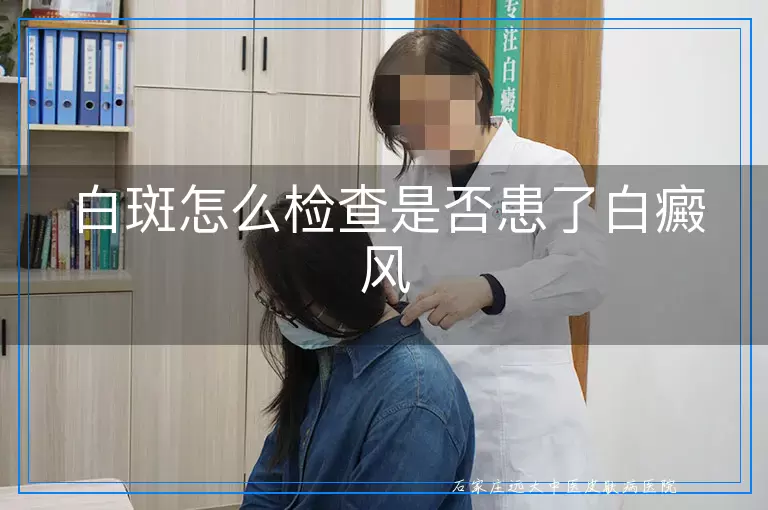 白斑怎么检查是否患了白癜风