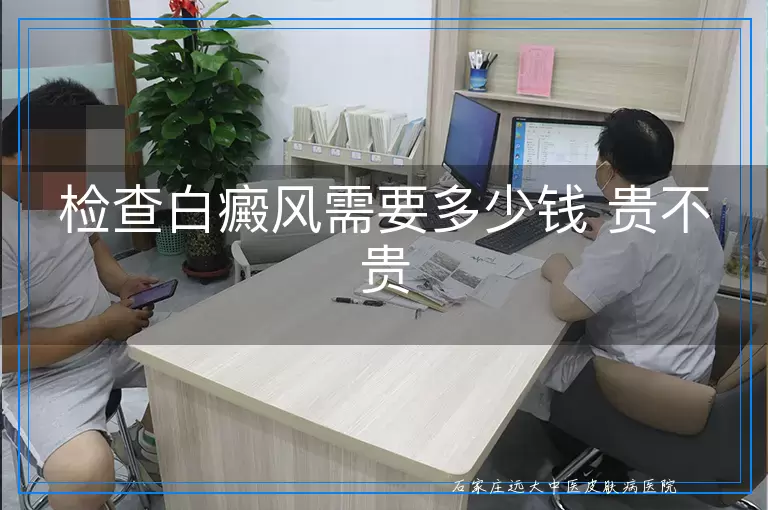 检查白癜风需要多少钱 贵不贵