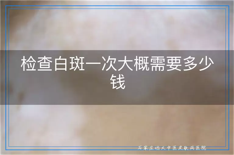 检查白斑一次大概需要多少钱