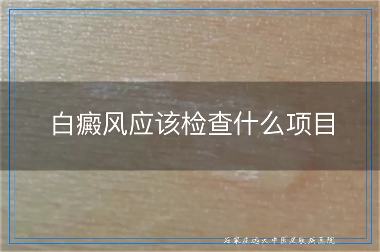 白癜风应该检查什么项目