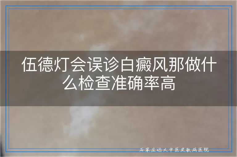 伍德灯会误诊白癜风那做什么检查准确率高