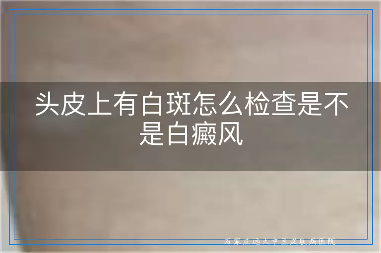 头皮上有白斑怎么检查是不是白癜风
