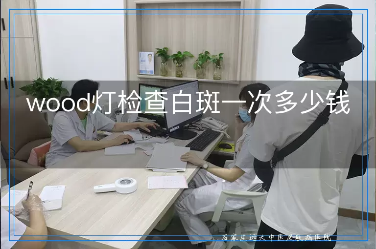 wood灯检查白斑一次多少钱