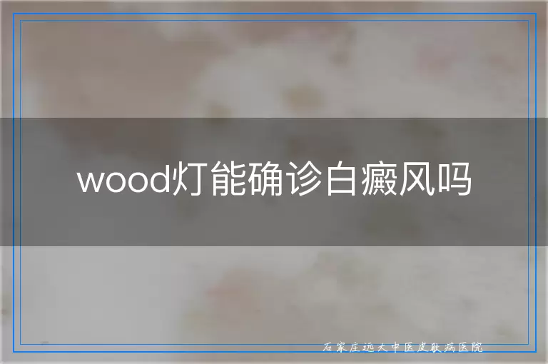 wood灯能确诊白癜风吗