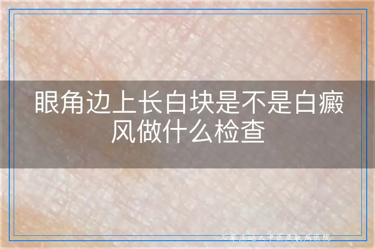 眼角边上长白块是不是白癜风做什么检查