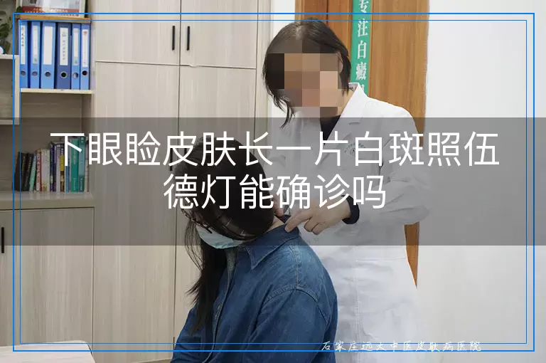 下眼睑皮肤长一片白斑照伍德灯能确诊吗