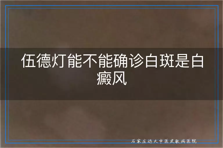 伍德灯能不能确诊白斑是白癜风