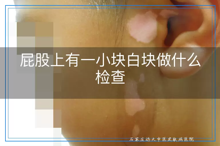 屁股上有一小块白块做什么检查