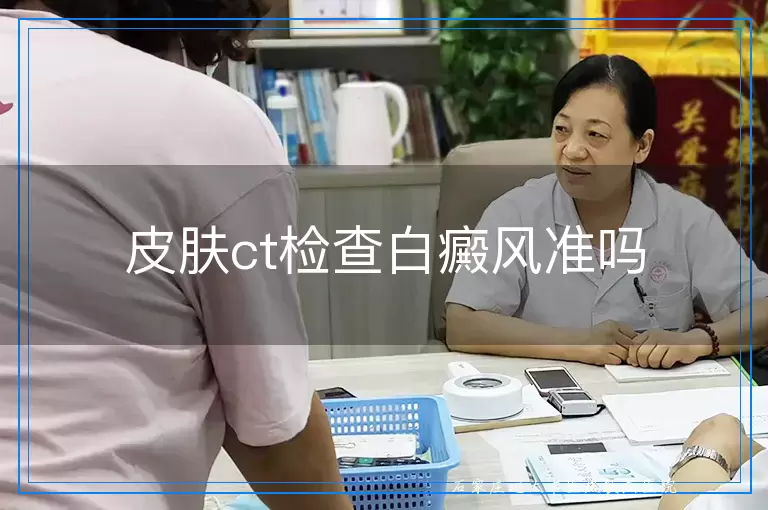 皮肤ct检查白癜风准吗