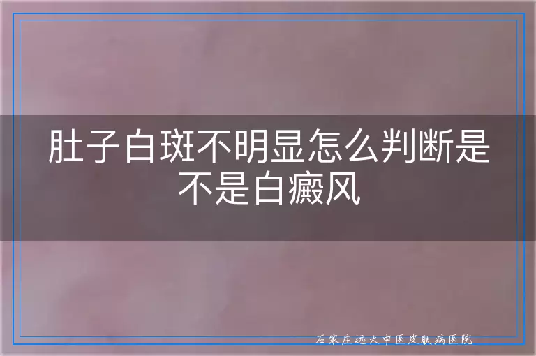 肚子白斑不明显怎么判断是不是白癜风