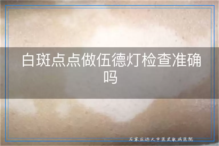 白斑点点做伍德灯检查准确吗