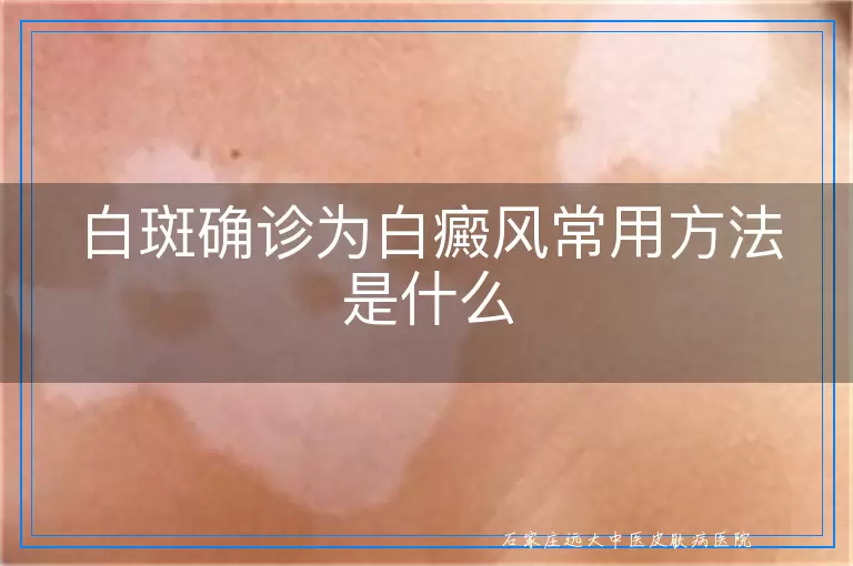 白斑确诊为白癜风常用方法是什么