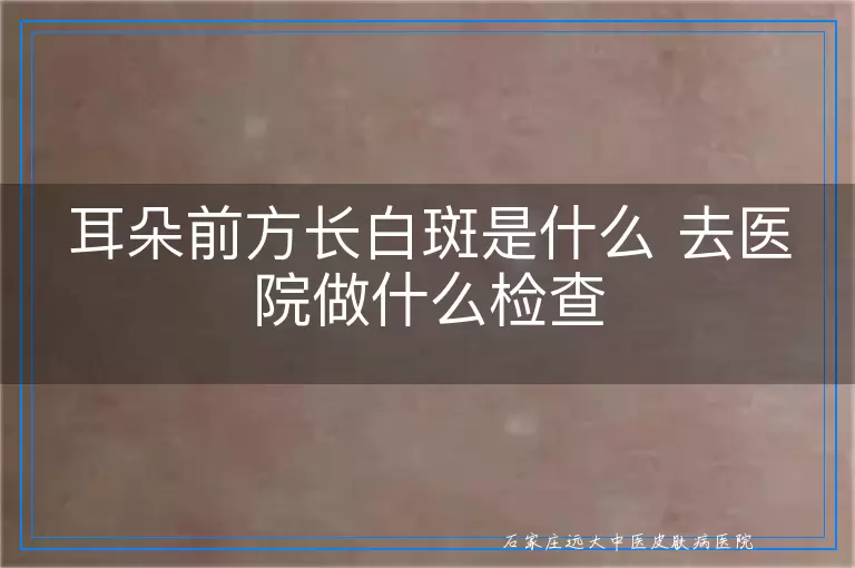 耳朵前方长白斑是什么 去医院做什么检查