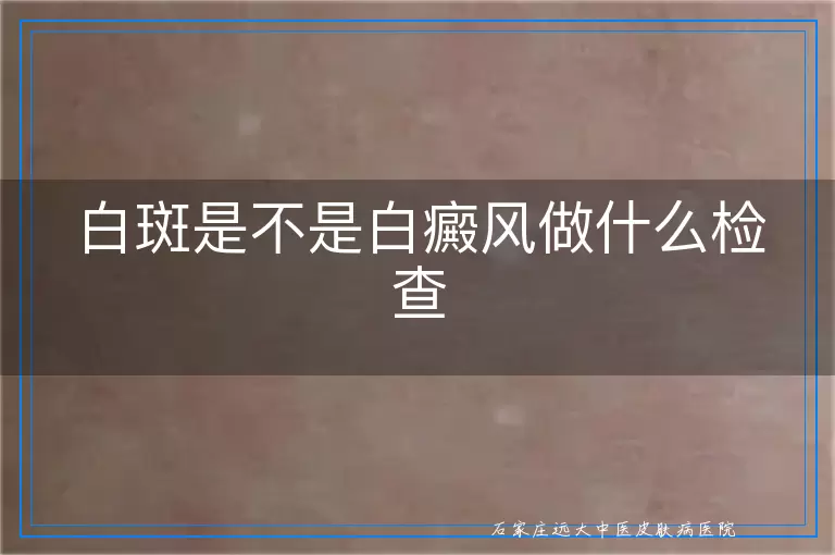 白斑是不是白癜风做什么检查