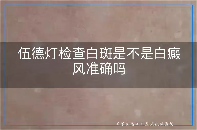 伍德灯检查白斑是不是白癜风准确吗