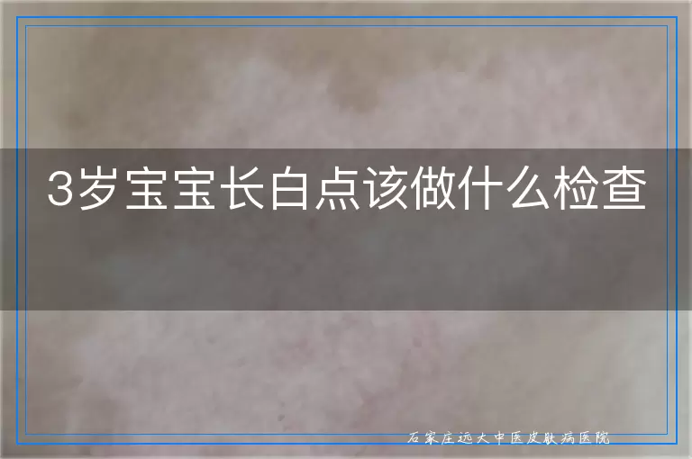 3岁宝宝长白点该做什么检查