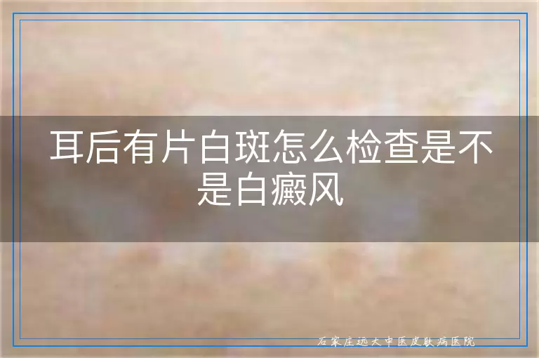 耳后有片白斑怎么检查是不是白癜风