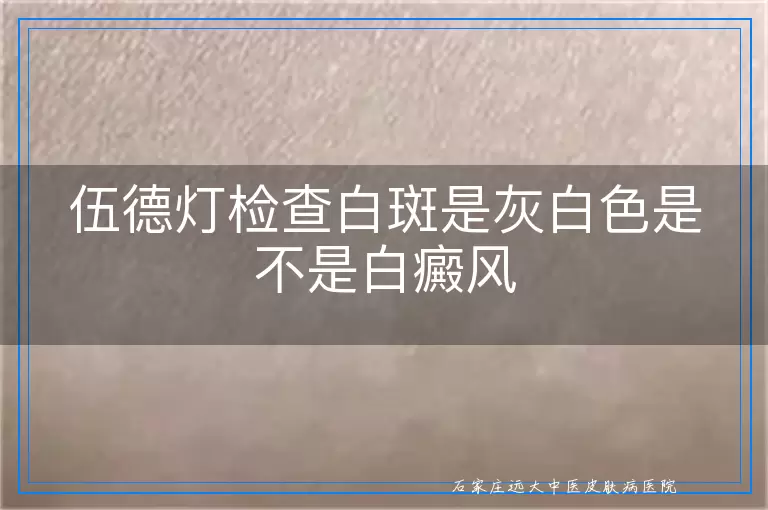 伍德灯检查白斑是灰白色是不是白癜风