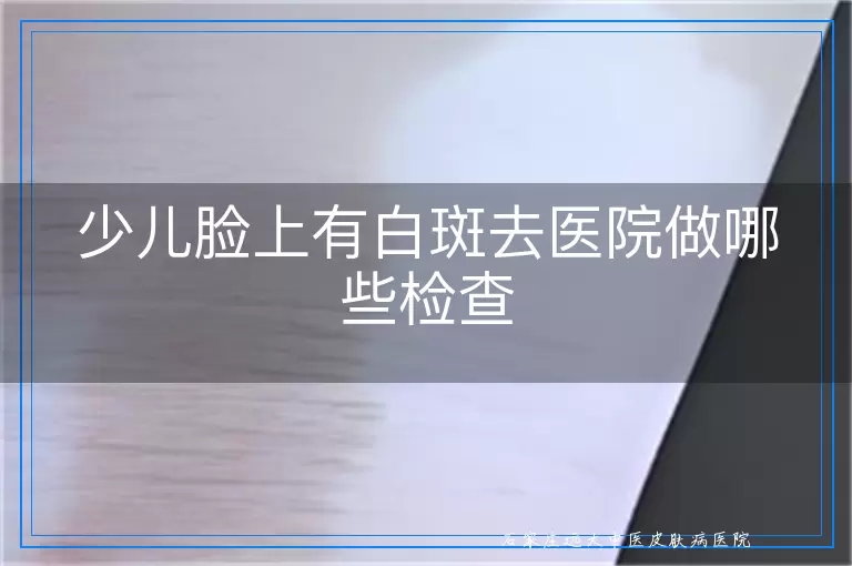 少儿脸上有白斑去医院做哪些检查