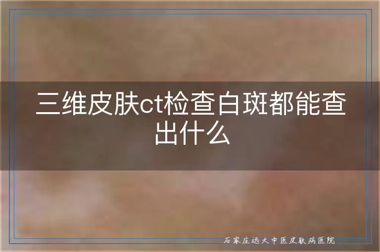 三维皮肤ct检查白斑都能查出什么