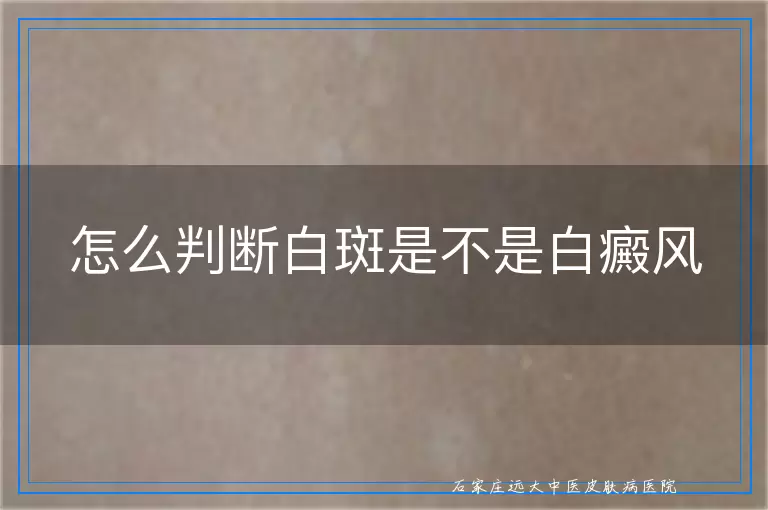怎么判断白斑是不是白癜风