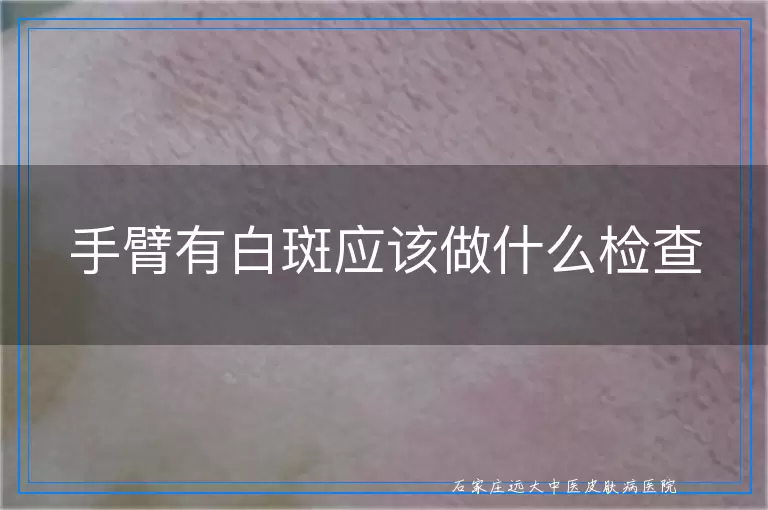 手臂有白斑应该做什么检查