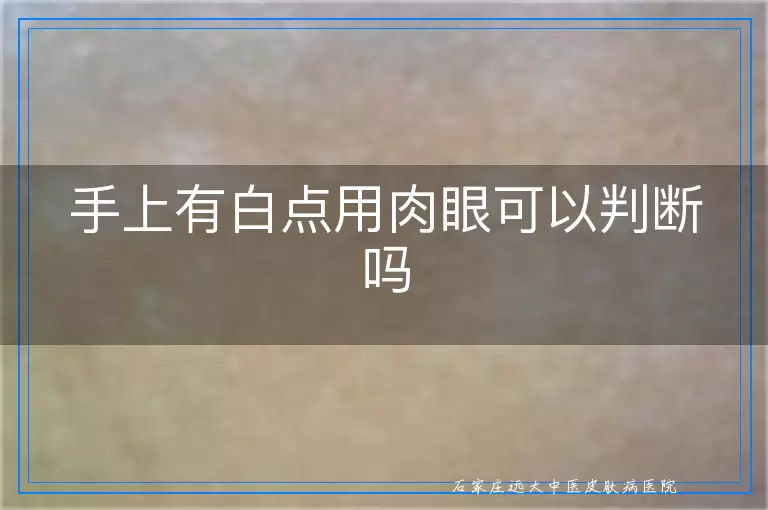手上有白点用肉眼可以判断吗