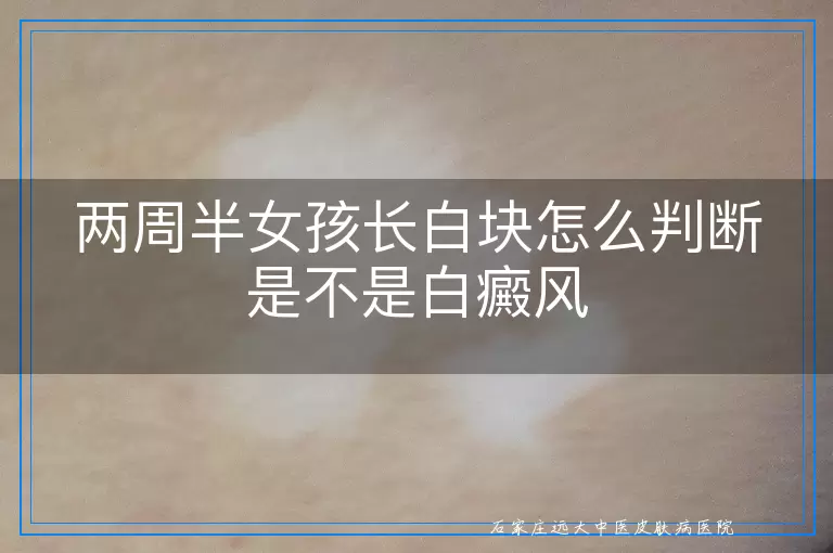 两周半女孩长白块怎么判断是不是白癜风