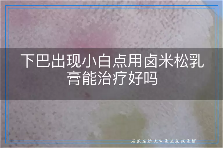 下巴出现小白点用卤米松乳膏能治疗好吗