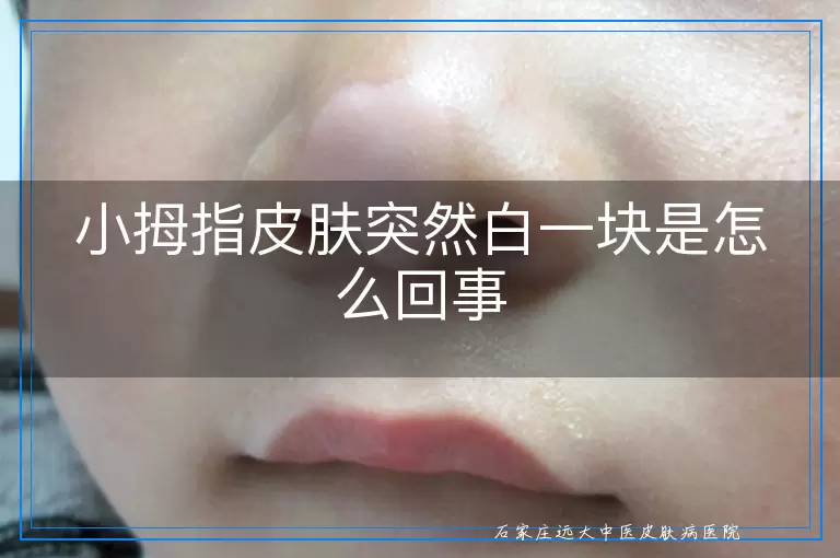 小拇指皮肤突然白一块是怎么回事