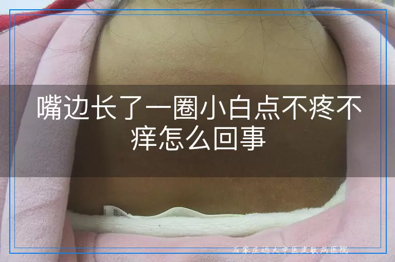 嘴边长了一圈小白点不疼不痒怎么回事