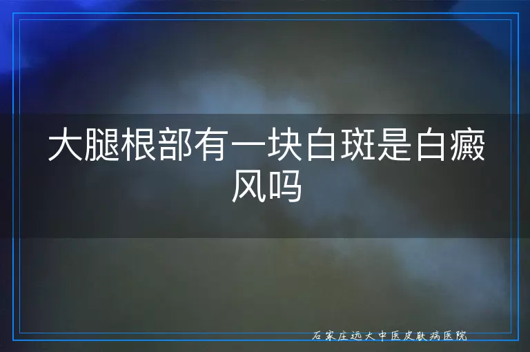 大腿根部有一块白斑是白癜风吗