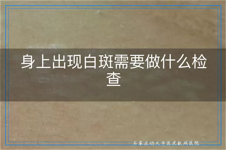 身上出现白斑需要做什么检查