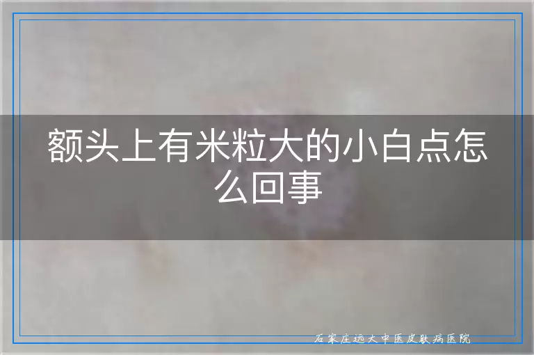 额头上有米粒大的小白点怎么回事