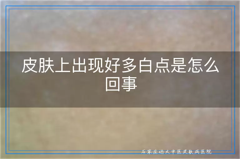 皮肤上出现好多白点是怎么回事