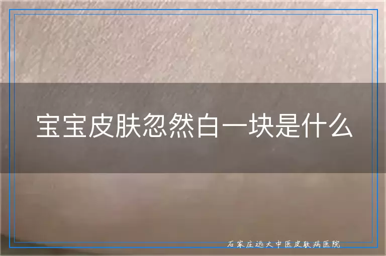 宝宝皮肤忽然白一块是什么