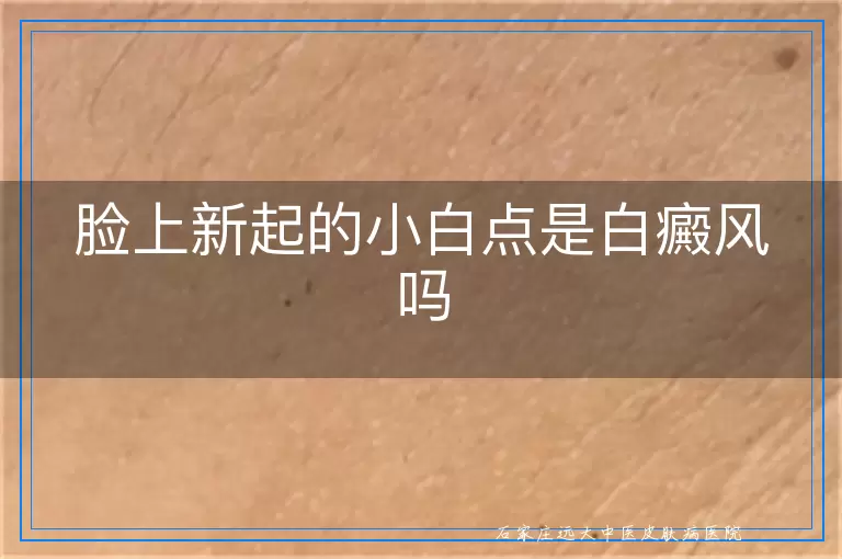 脸上新起的小白点是白癜风吗