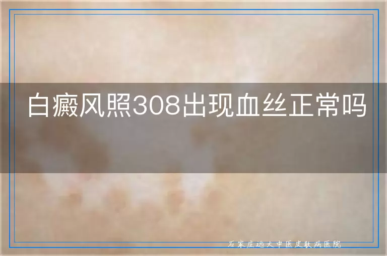 白癜风照308出现血丝正常吗