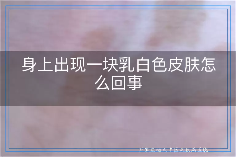 身上出现一块乳白色皮肤怎么回事