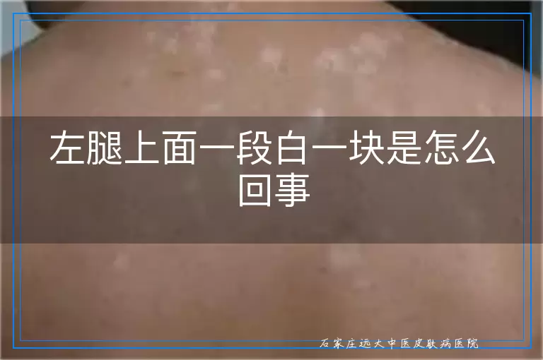 左腿上面一段白一块是怎么回事