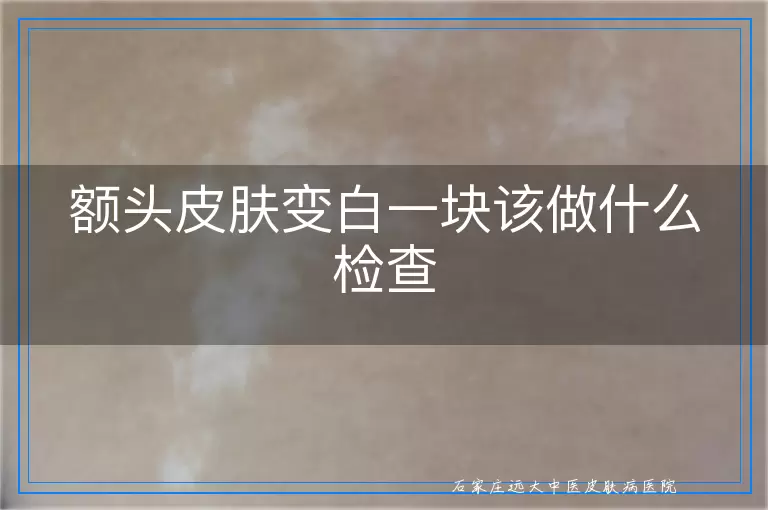 额头皮肤变白一块该做什么检查