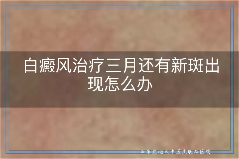 白癜风治疗三月还有新斑出现怎么办