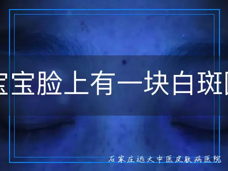 宝宝脸上有一块白斑图
