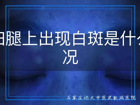 孕妇腿上出现白斑是什么情况