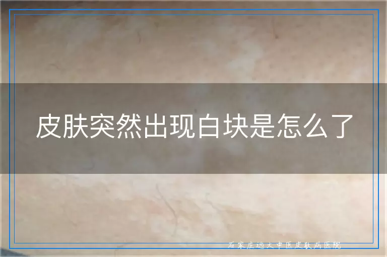 皮肤突然出现白块是怎么了