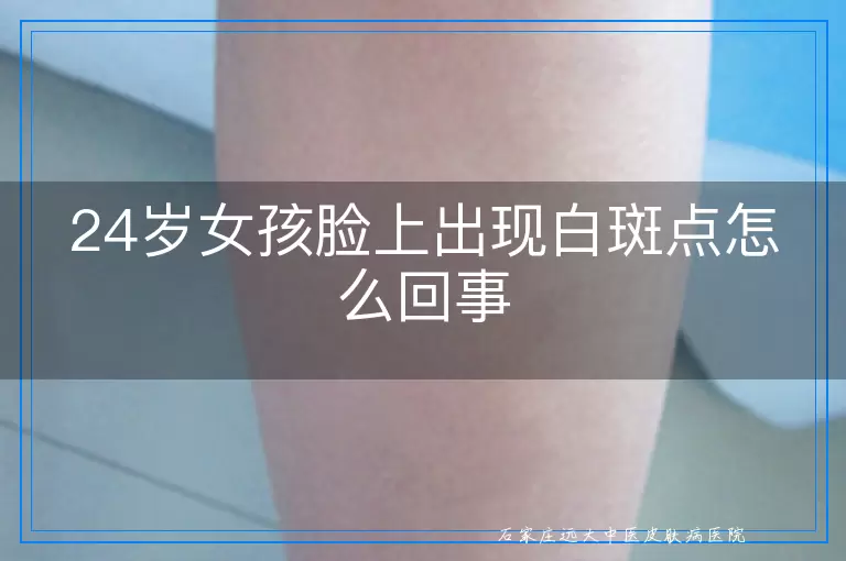 24岁女孩脸上出现白斑点怎么回事
