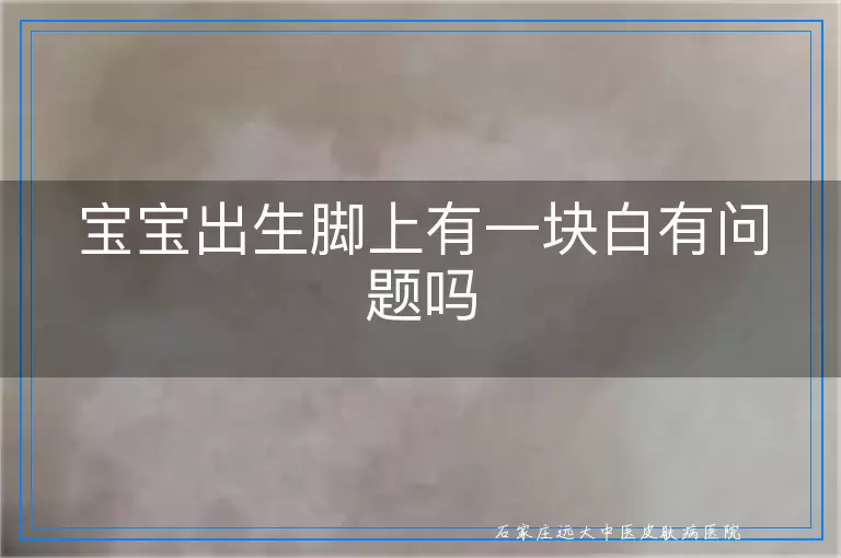 宝宝出生脚上有一块白有问题吗